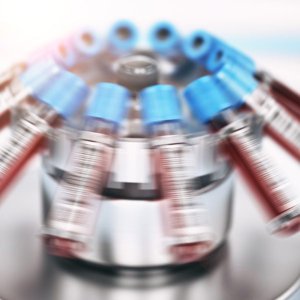 Centrífugas y Ultracentrífugas